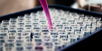 Equipa do i3S estuda latência da tuberculose para tentar entender o processo de eliminação da bactéria