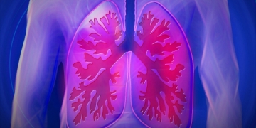 Pembrolizumab da MSD aprovado para o tratamento do CPCNP avançado