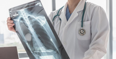 Fundação Champalimaud quer aumentar deteção precoce do mesotelioma associado ao amianto