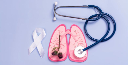 Pulmonale prepara ação de rua sobre cancro do pulmão