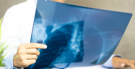 “Não se pode baixar a guarda no combate à tuberculose”