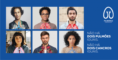“Não há dois pulmões iguais. Não há dois cancros iguais”