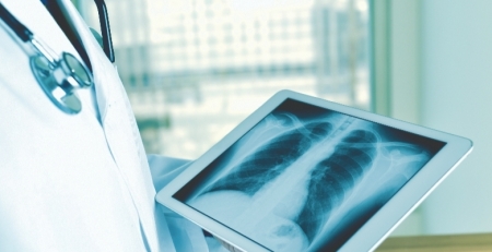 DGS emite novas recomendações para a DPOC