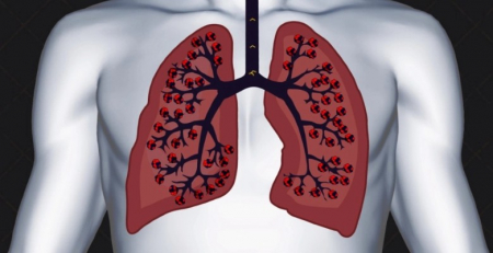 Novo tratamento aprovado na área do cancro do pulmão de não pequenas células