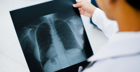 SPP lança campanha para cessação tabágica e aplaude comparticipação de medicamentos