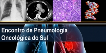 Conheça o programa científico do 4.º Encontro de Pneumologia Oncológica do Sul