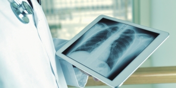 CHSJ nomeado centro de referência de fibrose quística