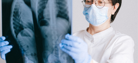 Dia Mundial Sem Tabaco: Tabagismo causa mais de 85% dos cancros do pulmão