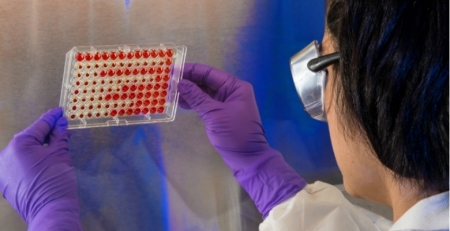 Investigadores estudam possibilidade do SARS-CoV-2 infetar células tumorais