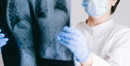 Especialistas questionam atrasos na aprovação de novos tratamentos para fibrose quística