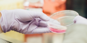 Ceftolozano/tazobactam cumpre endpoints primários de não-inferioridade a meropenem no tratamento de pneumonia adquirida no hospital ou associada ao ventilador