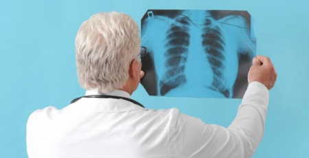 DGS promove nova sessão do ciclo de formação tuberculose 2024