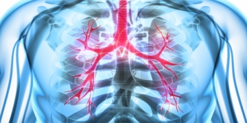 Portugal está entre os países que realizam mais transplantes pulmonares