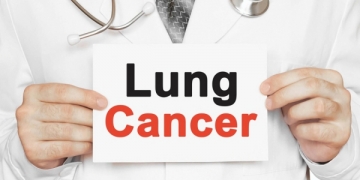 Portugal aprova financiamento de nivolumab para o tratamento de CPCNP