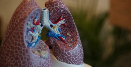 Tecnologia desenvolvida no Porto ajuda no diagnóstico de nódulos pulmonares