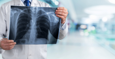 Robótica ajuda cirurgiões a combater o cancro do pulmão